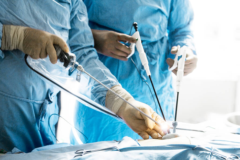 cirurgia laparoscopica